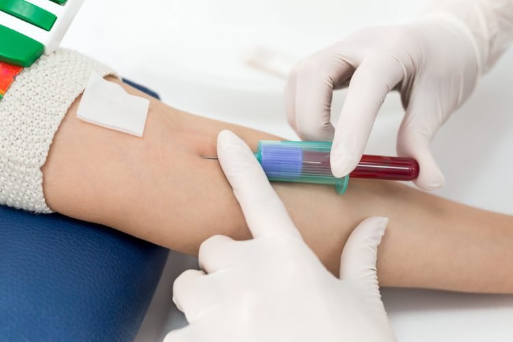 The Benefits of At-Home Blood Tests