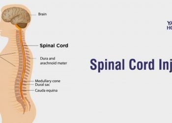 Spinal injury: The Importance Of getting First Aid Right