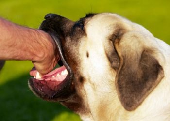 The 4 Things To Do When You Are Bitten By A Dog