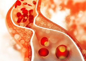 Understanding Cholesterol Markers