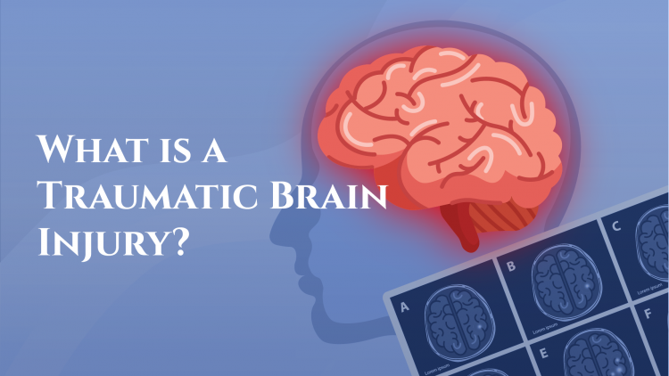 How To Handle A Traumatic Brain Injury In California