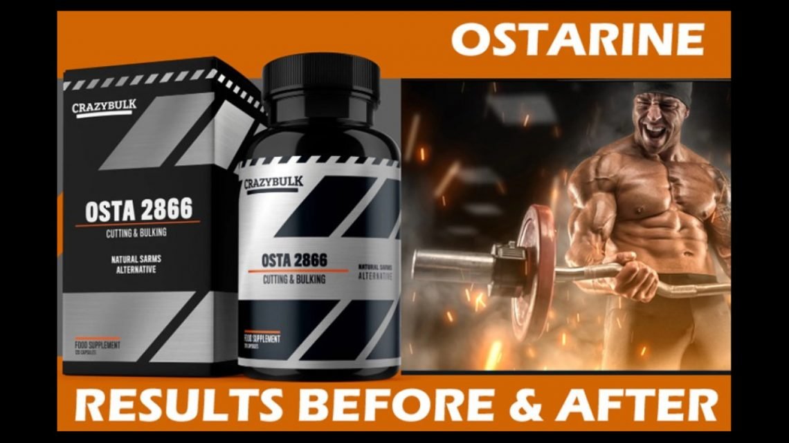 Everything You Should Know About Ostarine For Sale