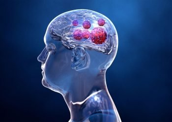 6 Overlooked Symptoms of Traumatic Brain Injury