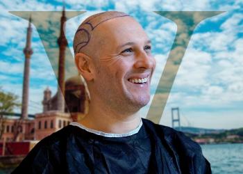Your Hair, Your Way: Tailor-made Operation In Istanbul Vita