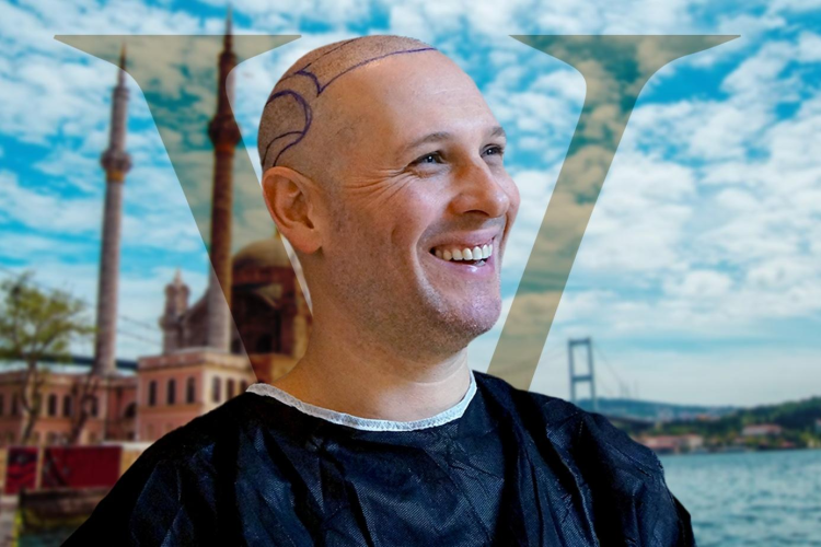 Your Hair, Your Way: Tailor-made Operation In Istanbul Vita