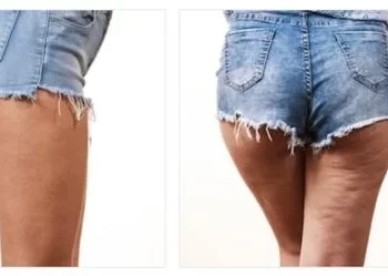 Are there any before-and-after photos or customer reviews available for CelluAid products?