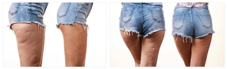 Are there any before-and-after photos or customer reviews available for CelluAid products?