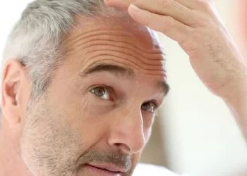 Hair Loss and Aging: Navigating the Changes with Grace