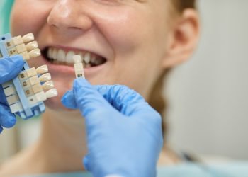 The Lifespan of Dental Implants: How Long Do They Last?