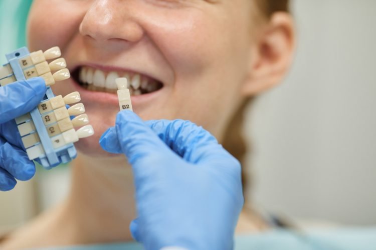 The Lifespan of Dental Implants: How Long Do They Last?